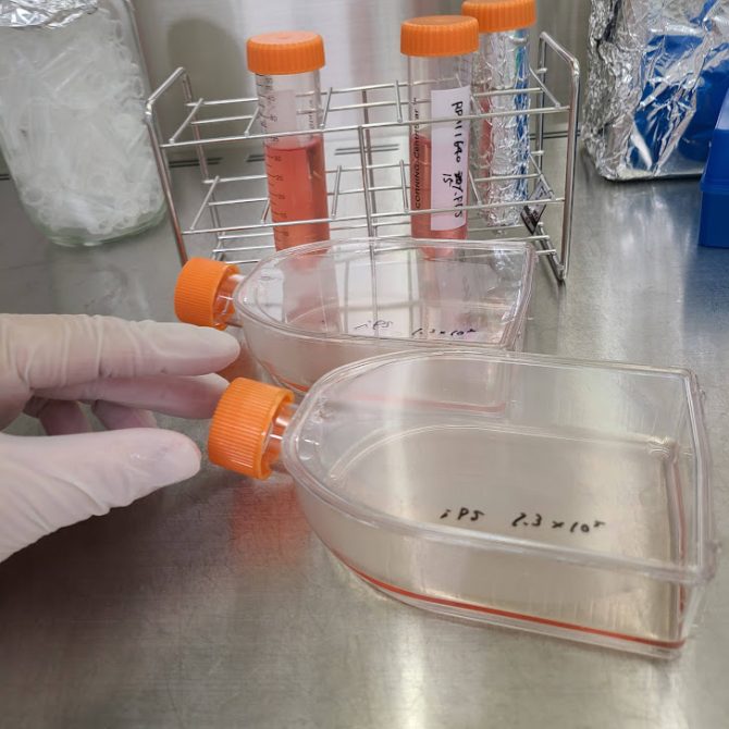 白い手袋をはめた研究者が細胞培養フラスコを扱っている。フラスコには「iPS 2.3 x 10^5」と細胞の種類と数が手書きで記されている。背景には試験管立てに立てられた遠沈管がある。