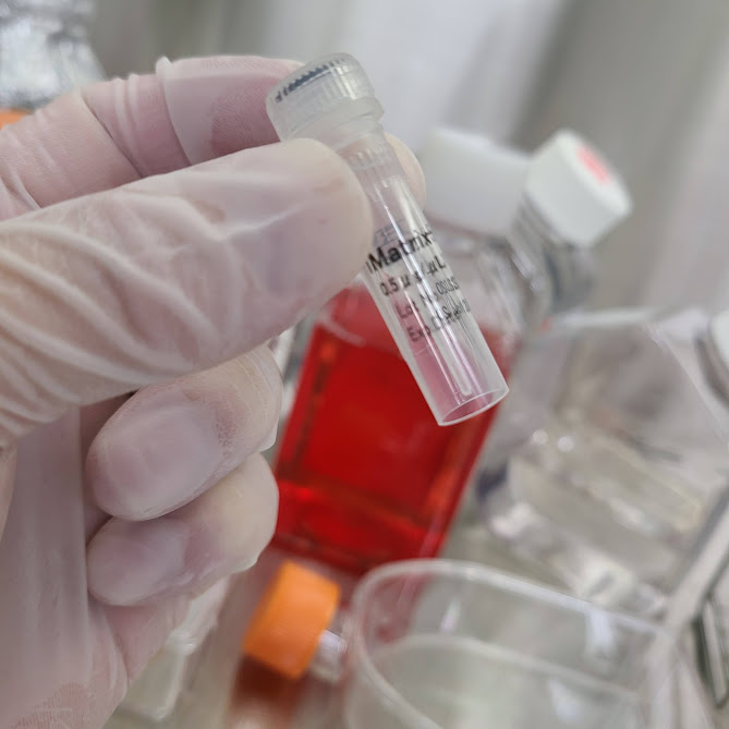 手袋をはめた手が、試薬の入った小さなマイクロチューブを持っている。チューブのラベルには「Matrigel」と製品名や濃度が記載されている。背景には実験器具がぼやけて写っている。